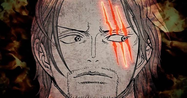 Shanks