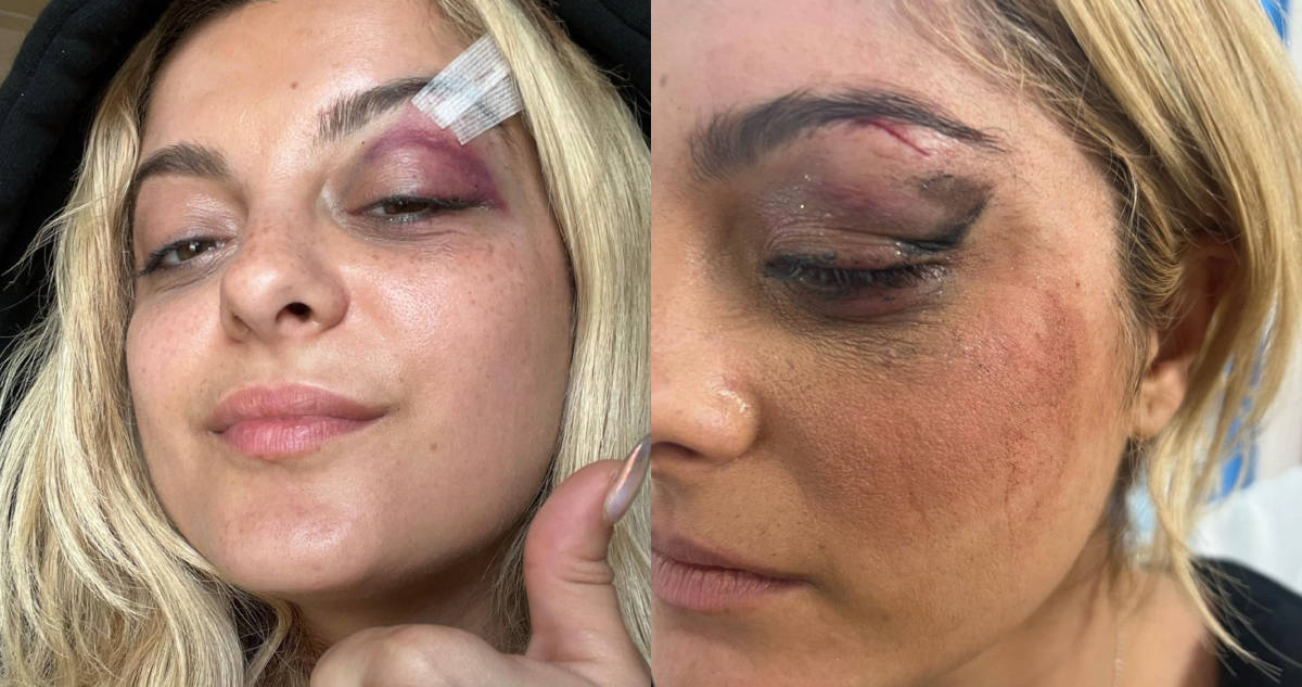 Concertgoer injures Bebe Rexha, shocking incident caught on camera in NYC concert. 13