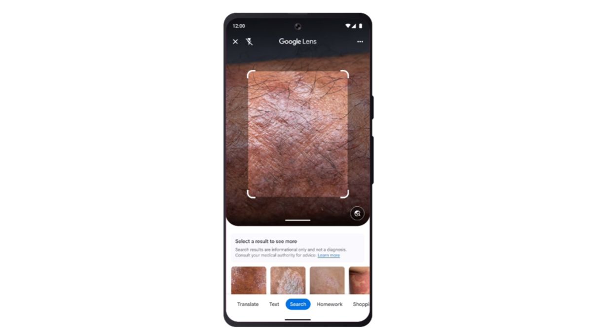 Google's New Web-Based App Can Identify Skin Conditions and Rashes - Try Derm Assist Today! 29