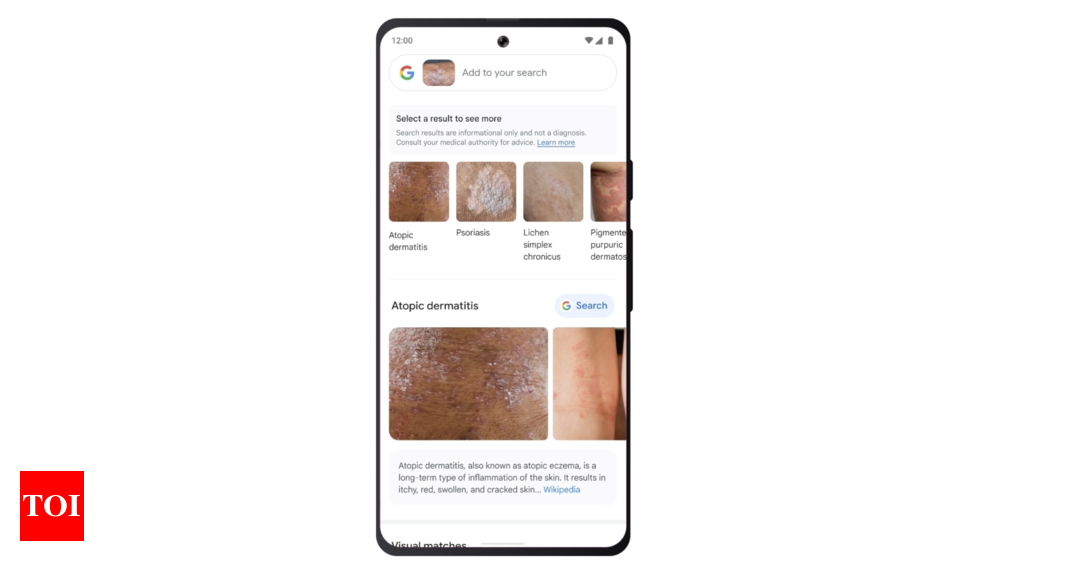 Google's New Web-Based App Can Identify Skin Conditions and Rashes - Try Derm Assist Today! 21