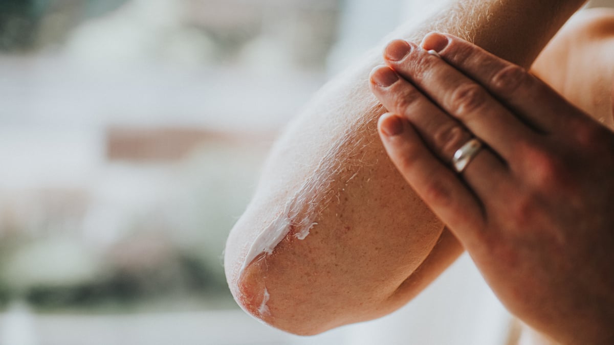Google's New Web-Based App Can Identify Skin Conditions and Rashes - Try Derm Assist Today! 23
