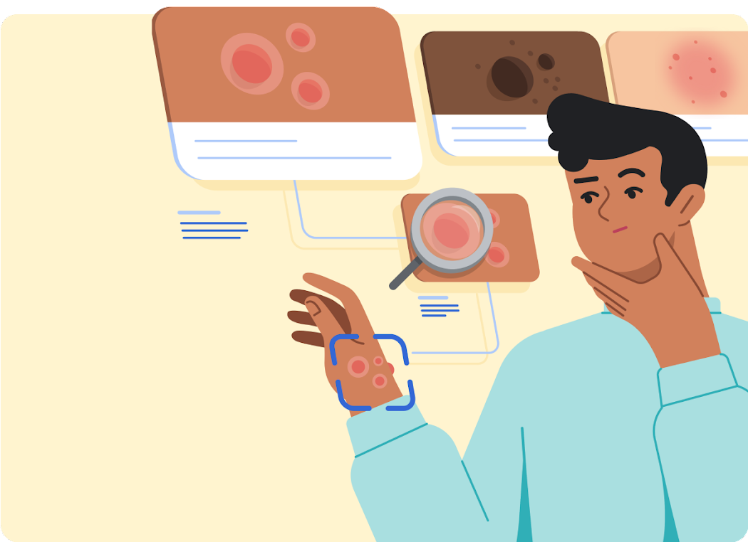 Google's New Web-Based App Can Identify Skin Conditions and Rashes - Try Derm Assist Today! 27