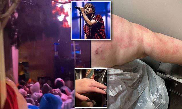 Hailstorm at Red Rocks Amphitheater: Tomlinson's Concert Canceled and Fans Injured 24