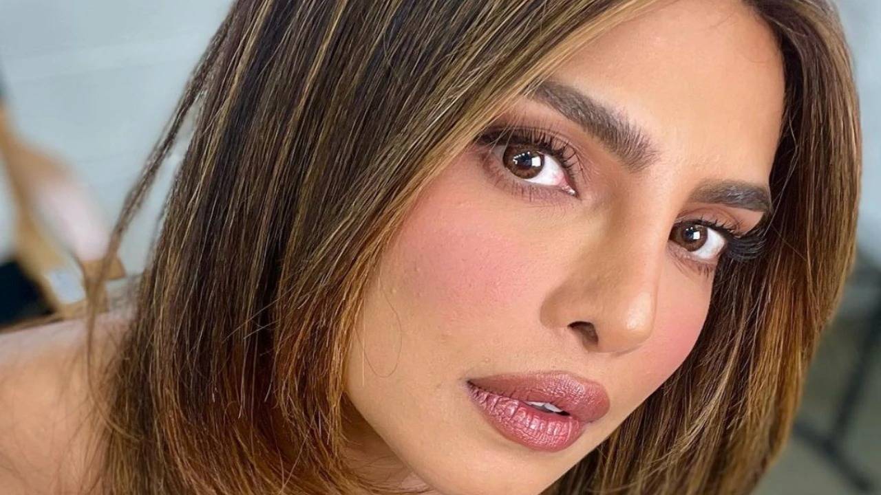 Priyanka Chopra Reveals Bandaged Legs in Behind-the-Scenes Photo from New Action Thriller 14