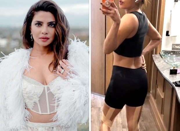 Priyanka Chopra Reveals Bandaged Legs in Behind-the-Scenes Photo from New Action Thriller 15