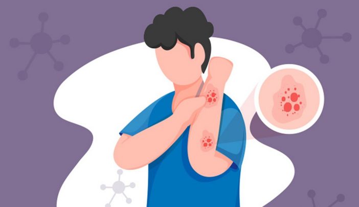 Google's New Web-Based App Can Identify Skin Conditions and Rashes - Try Derm Assist Today! 30